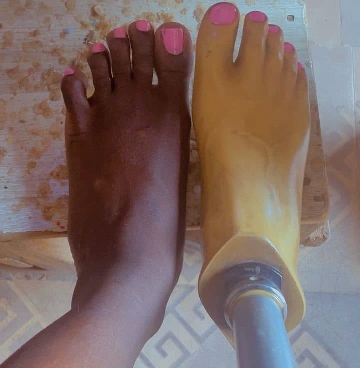 A foot next to a prosthetic foot on a wooden surface, both with pink nail polish.