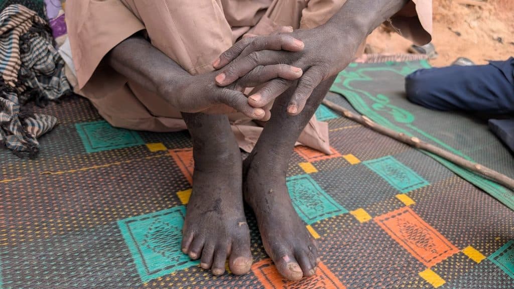 Crossed legs and folded hands of a person seated on a colorful mat.
