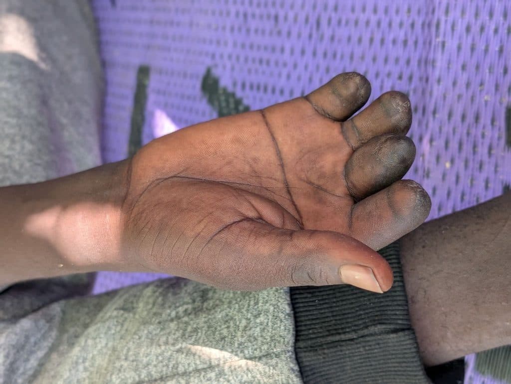A hand with darkened fingertips and palm, resting on a purple mat with light and shadow patterns.