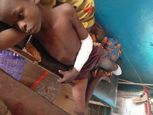 Child with bandaged arm and leg resting on a clinic bed, surrounded by colorful pillows and a blue wall.